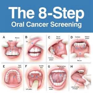 8-Step Oral Cancer Screening