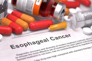 Esophageal Cancer