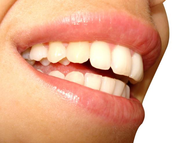 Closeup of a smile