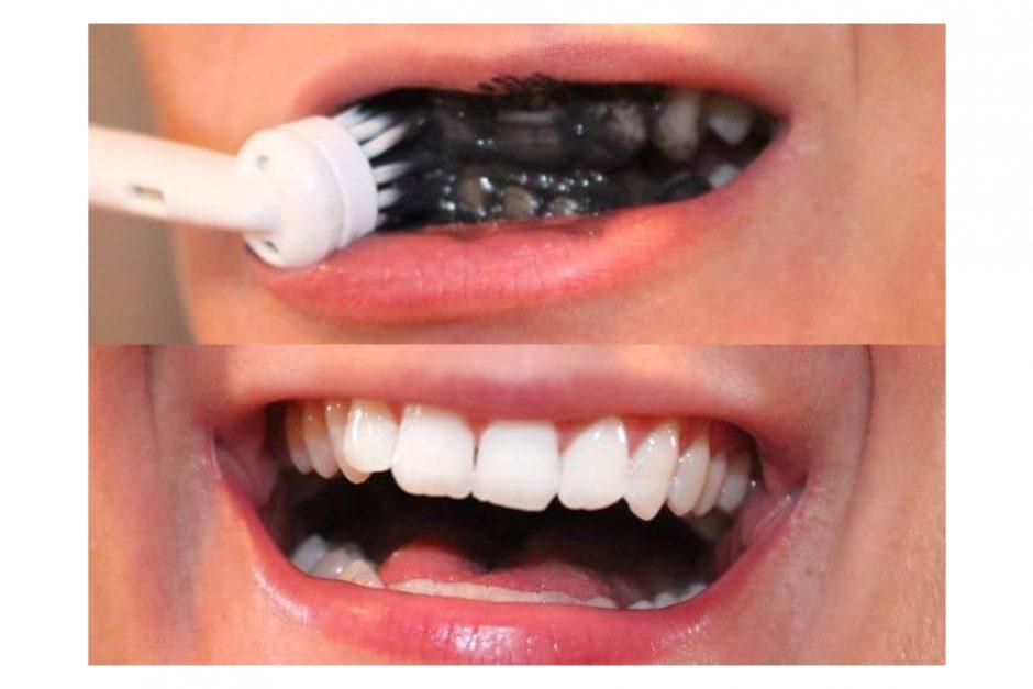 Black Toothpaste