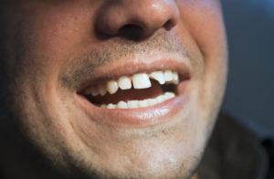 Toothaches | Dentistry in Maricopa