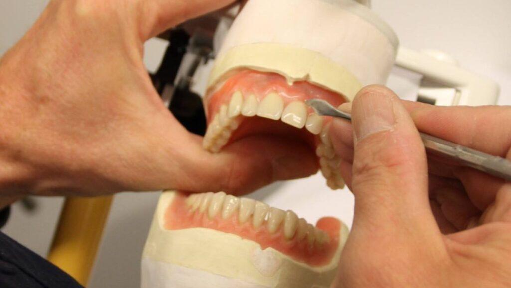 Adjusting to Dentures in 3 Steps