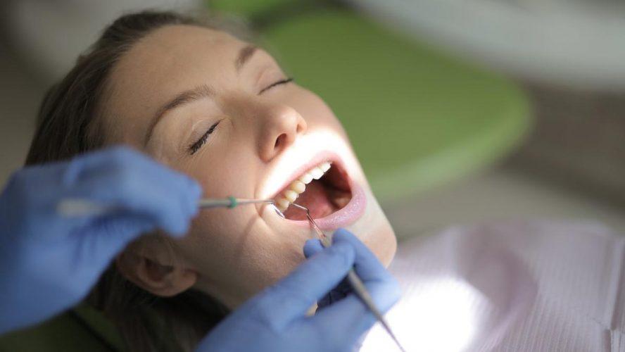 What Is the Average Lifespan of a Dental Filling