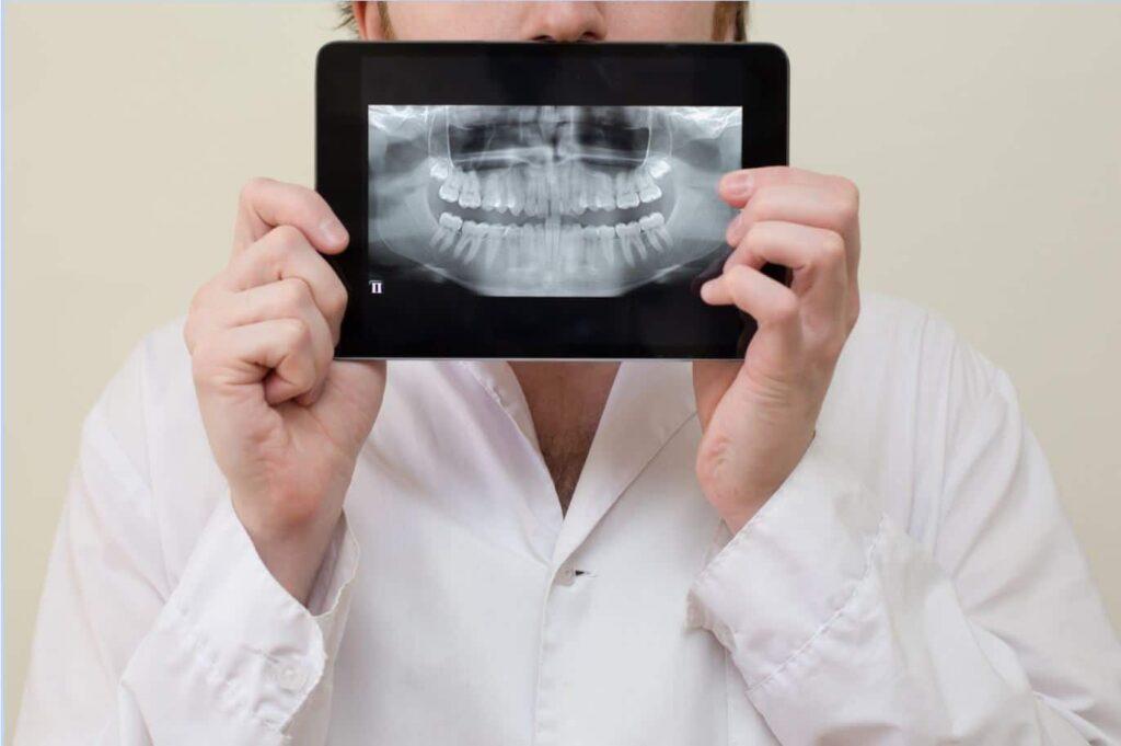 How Getting Dental X-Rays Can Help You Save Money