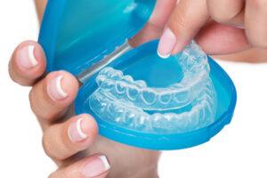 SureSmile Aligners