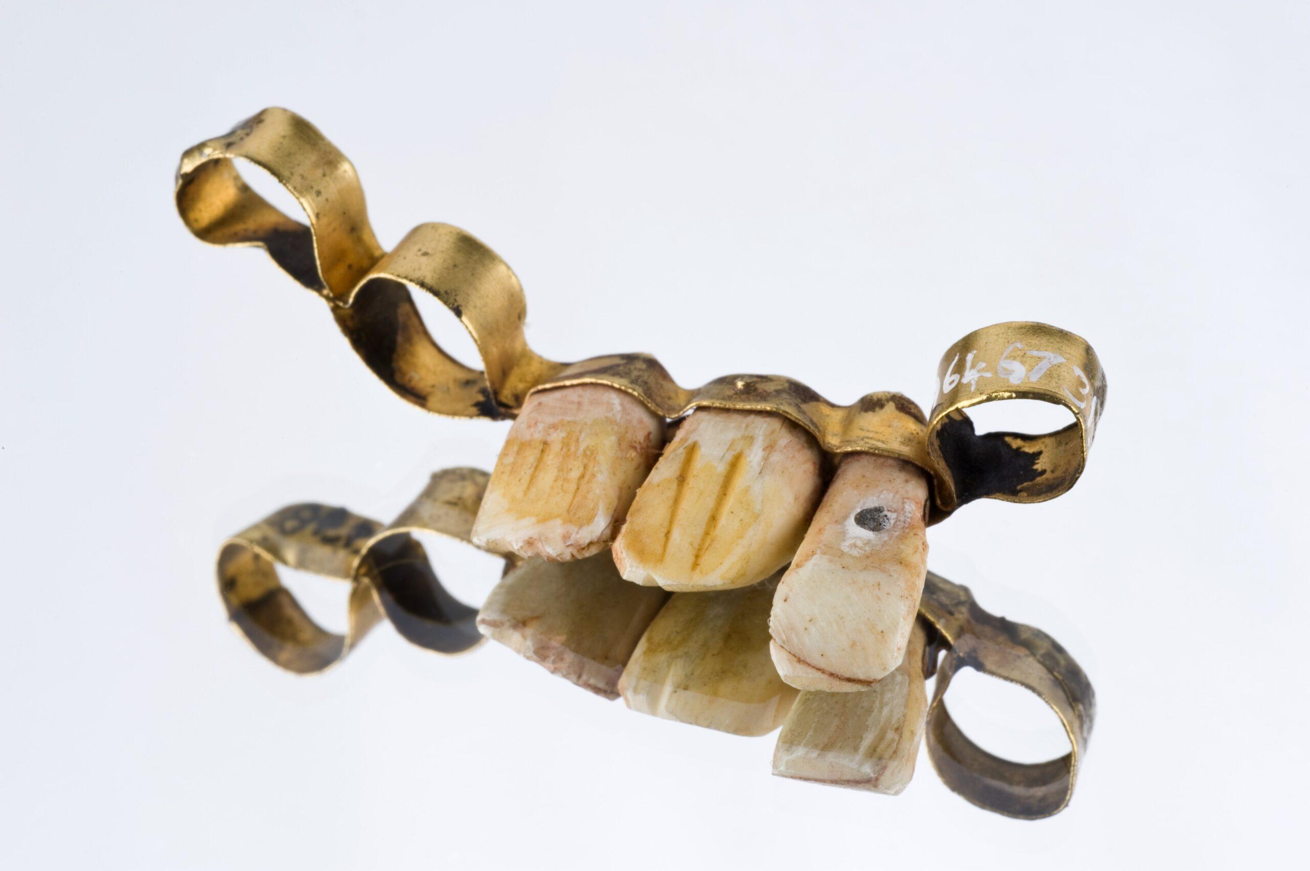 Roman Dental Bridge