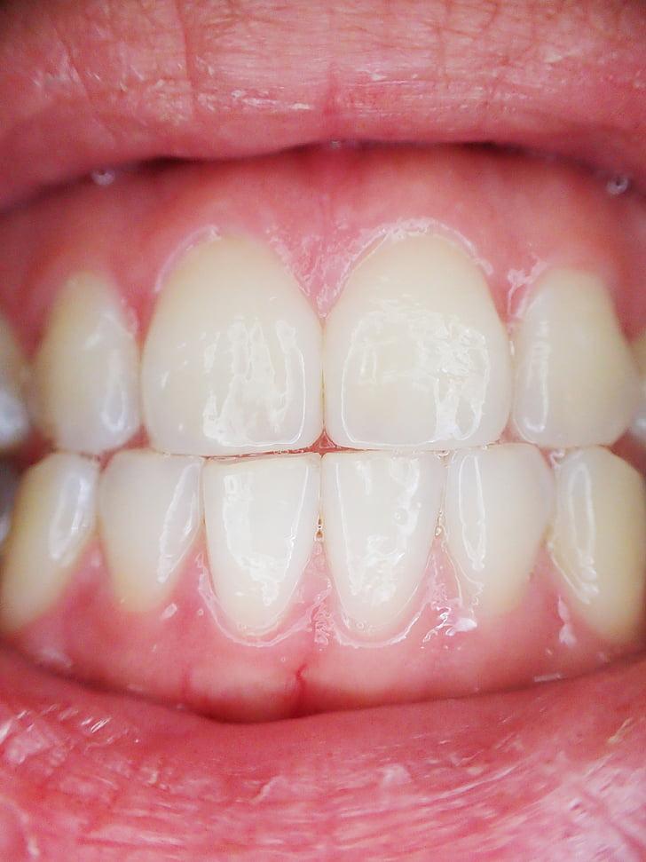 Healthy Gums