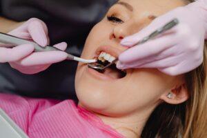 Professional Teeth Cleaning