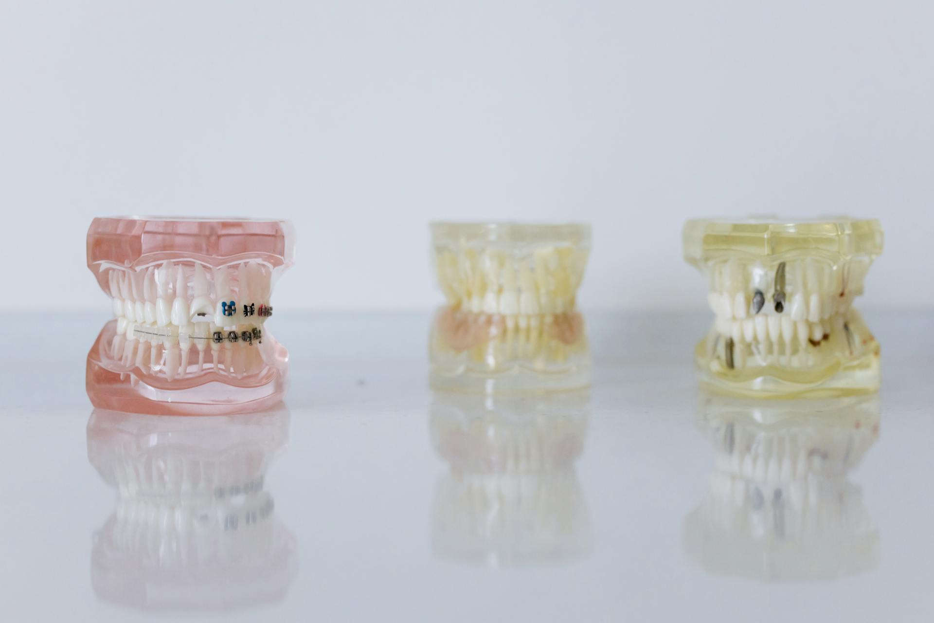 Comprehensive Denture Services in Orem, Utah