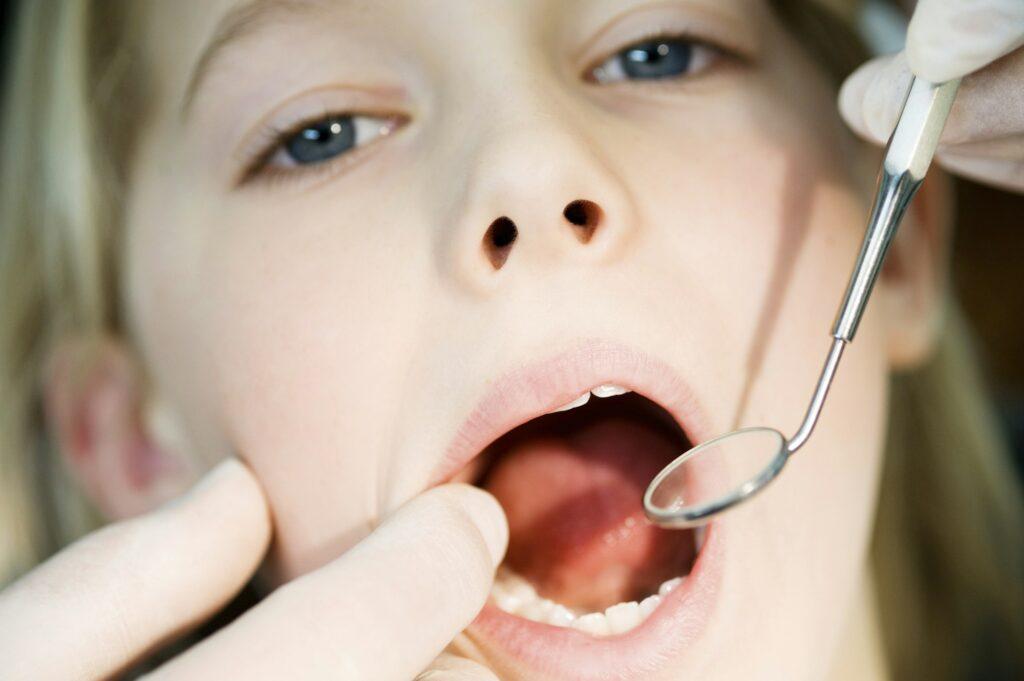 Child at a dental checkup