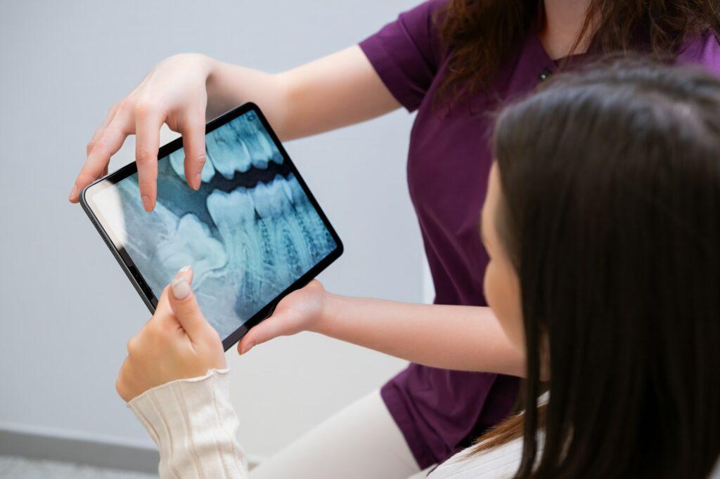 Dentist discussing tooth extraction procedure with patient showing x-rays