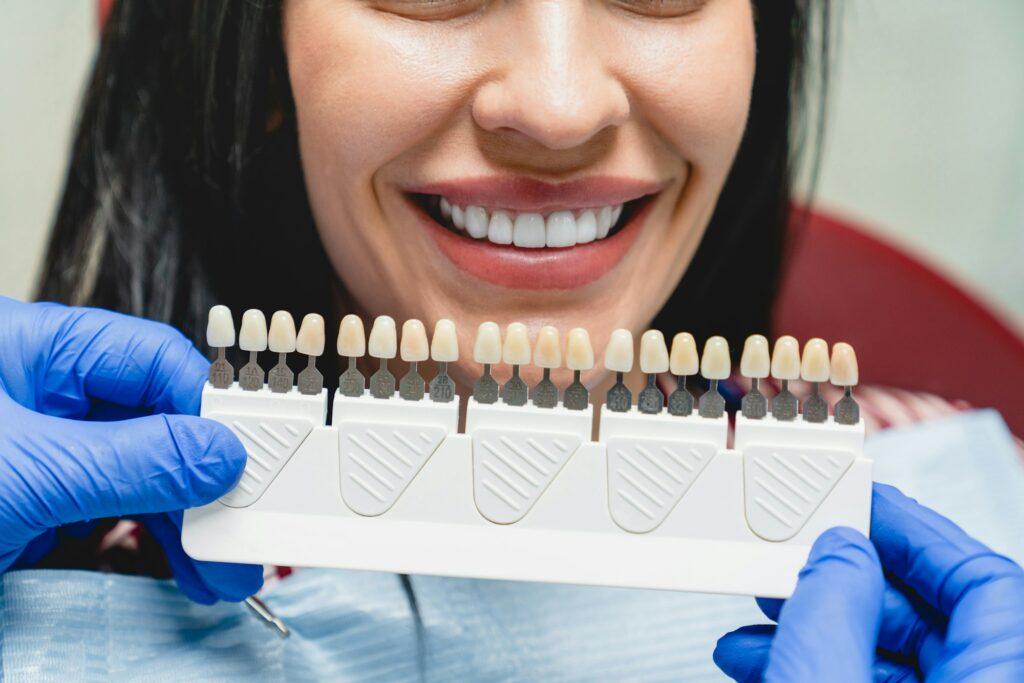 Whitening concept. Dental care, implants,veneers. Woman with perfect smile choosing teeth tooth tone