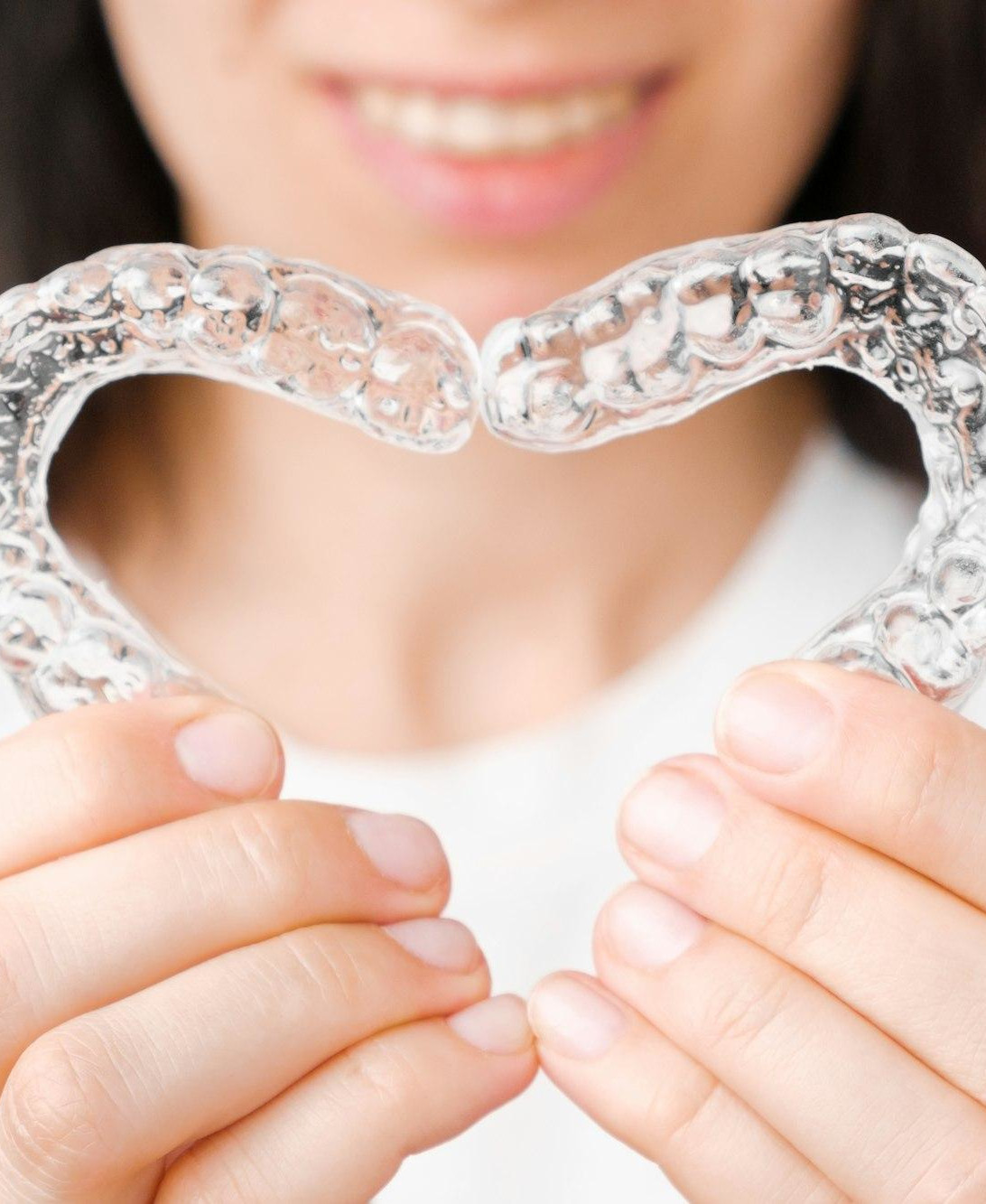 SureSmile 2 SureSmile Aligners