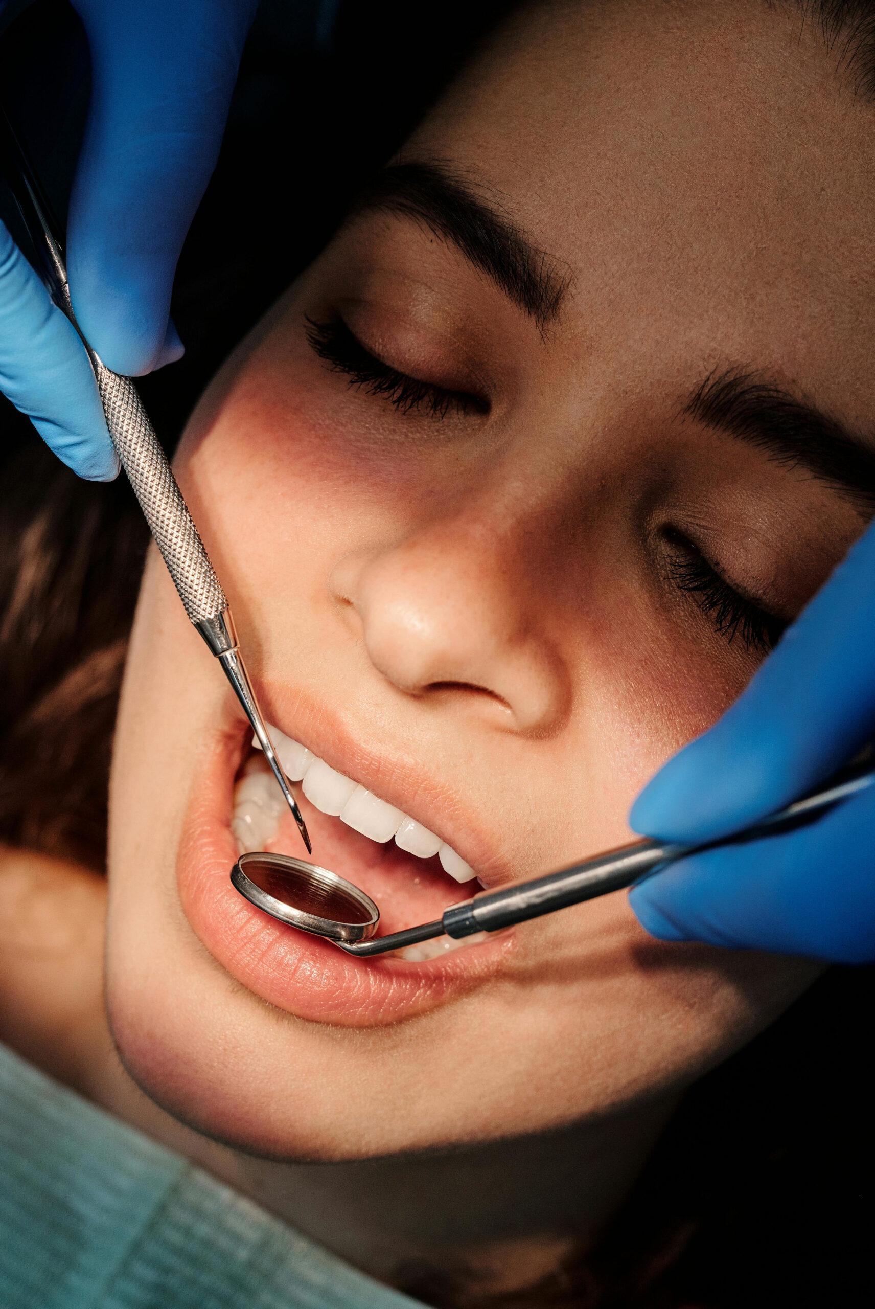 Wisdom Teeth Extractions 2 Dental Exam