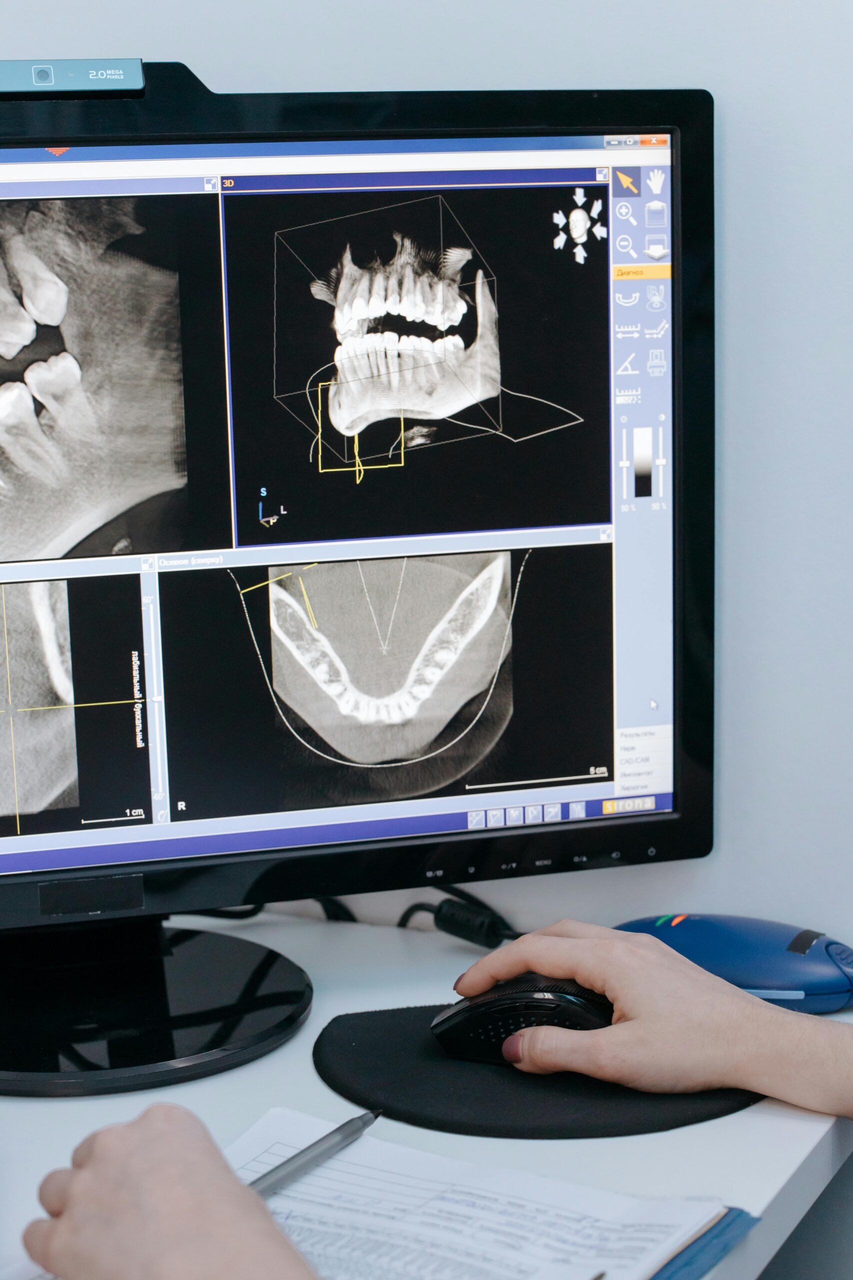Digital X-Rays 1 Digital Z-rays