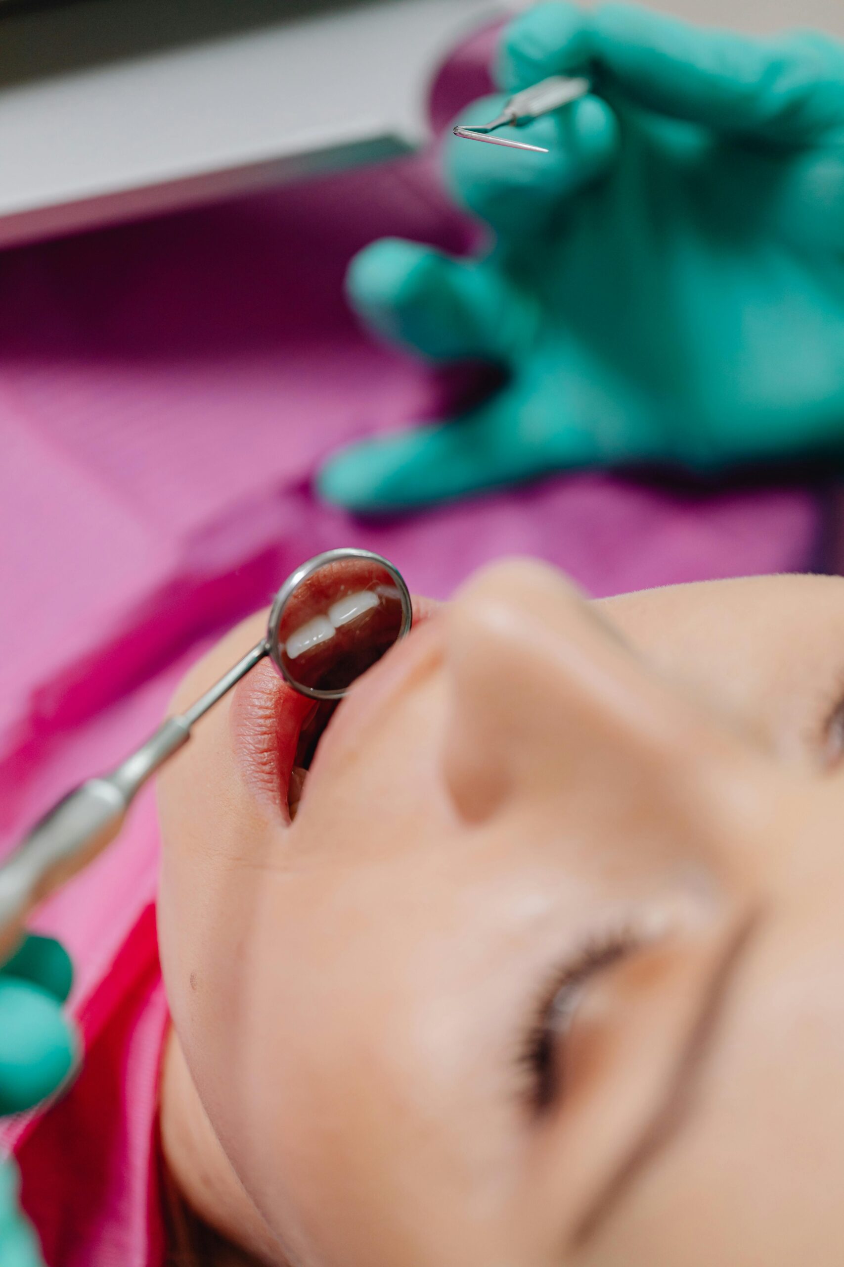 Root Canals 2 Dental Exam