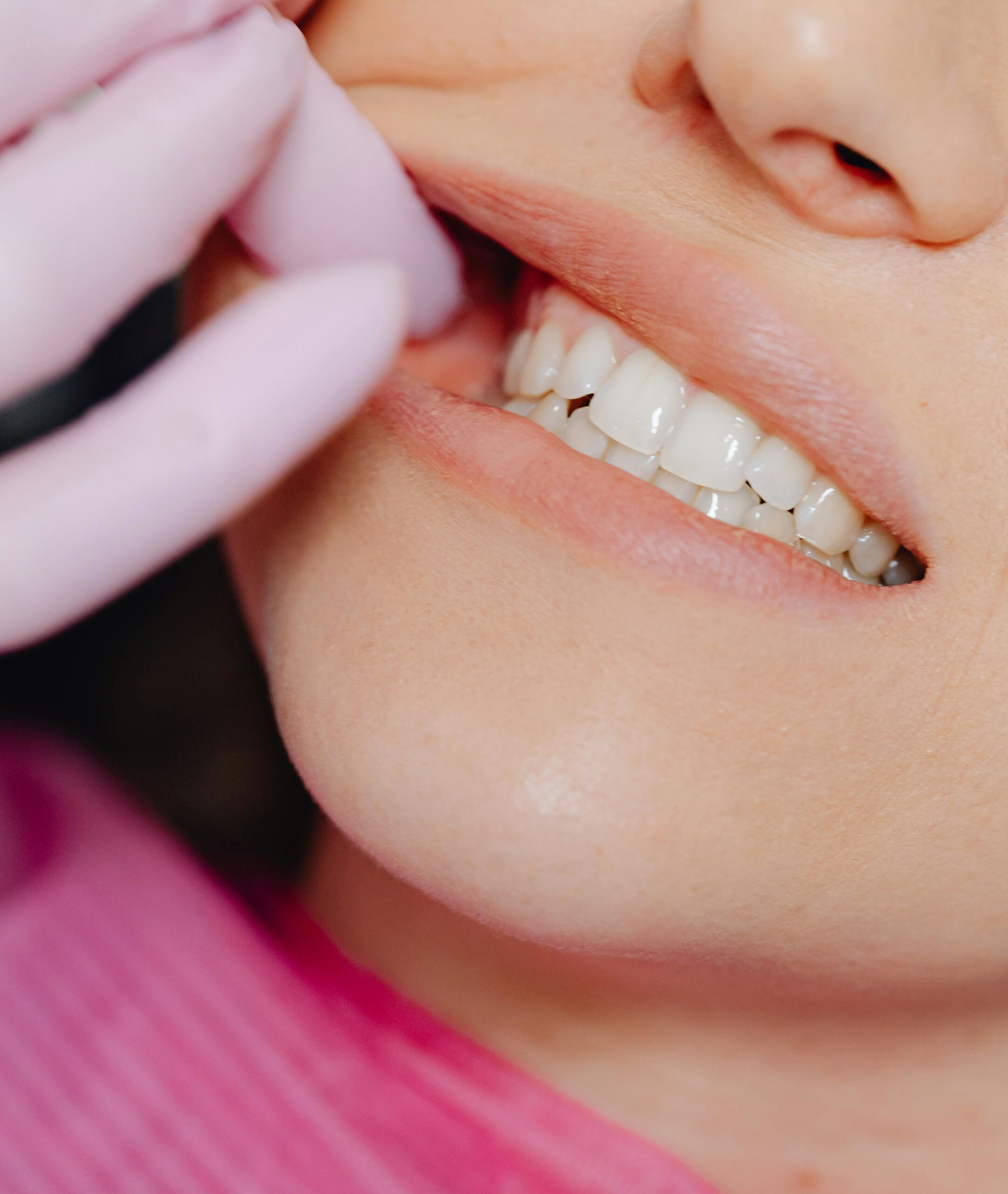 Sealants 1 Dental Patient Getting a Dental Sealants