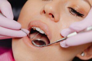 Professional Dental Cleaning