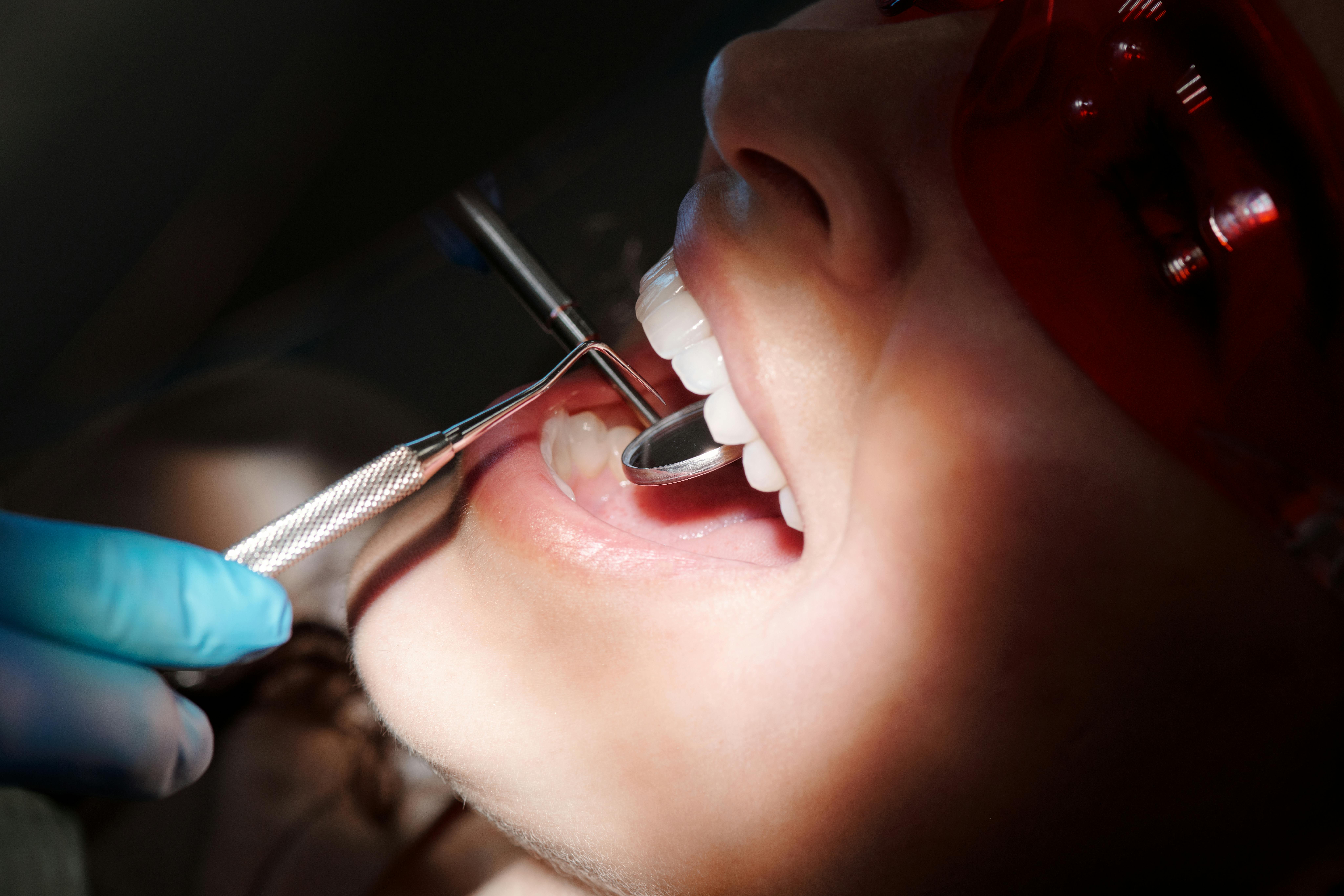 Dentist examining patient’s teeth using dental mirror and scaler during oral checkup, with patient wearing protective red-tinted glasses