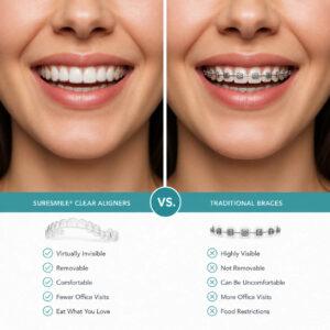 Side-by-side comparison of SureSmile clear aligners and traditional metal braces shown at Canyon Gate Dental in Orem Utah
