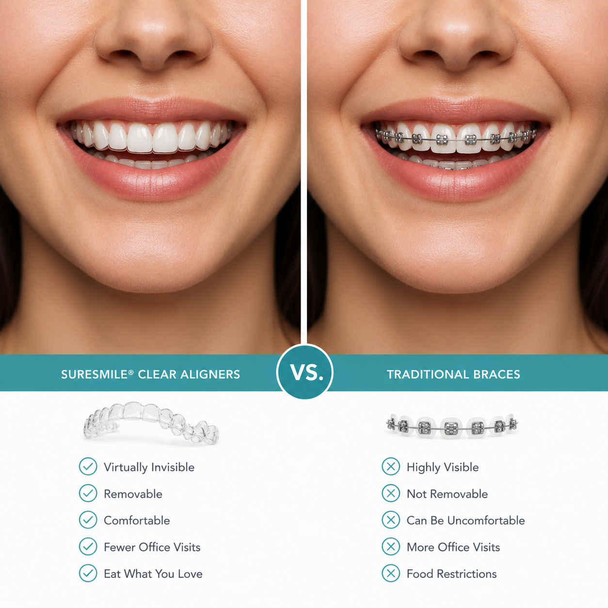 Side-by-side comparison of SureSmile clear aligners and traditional metal braces shown at Canyon Gate Dental in Orem Utah