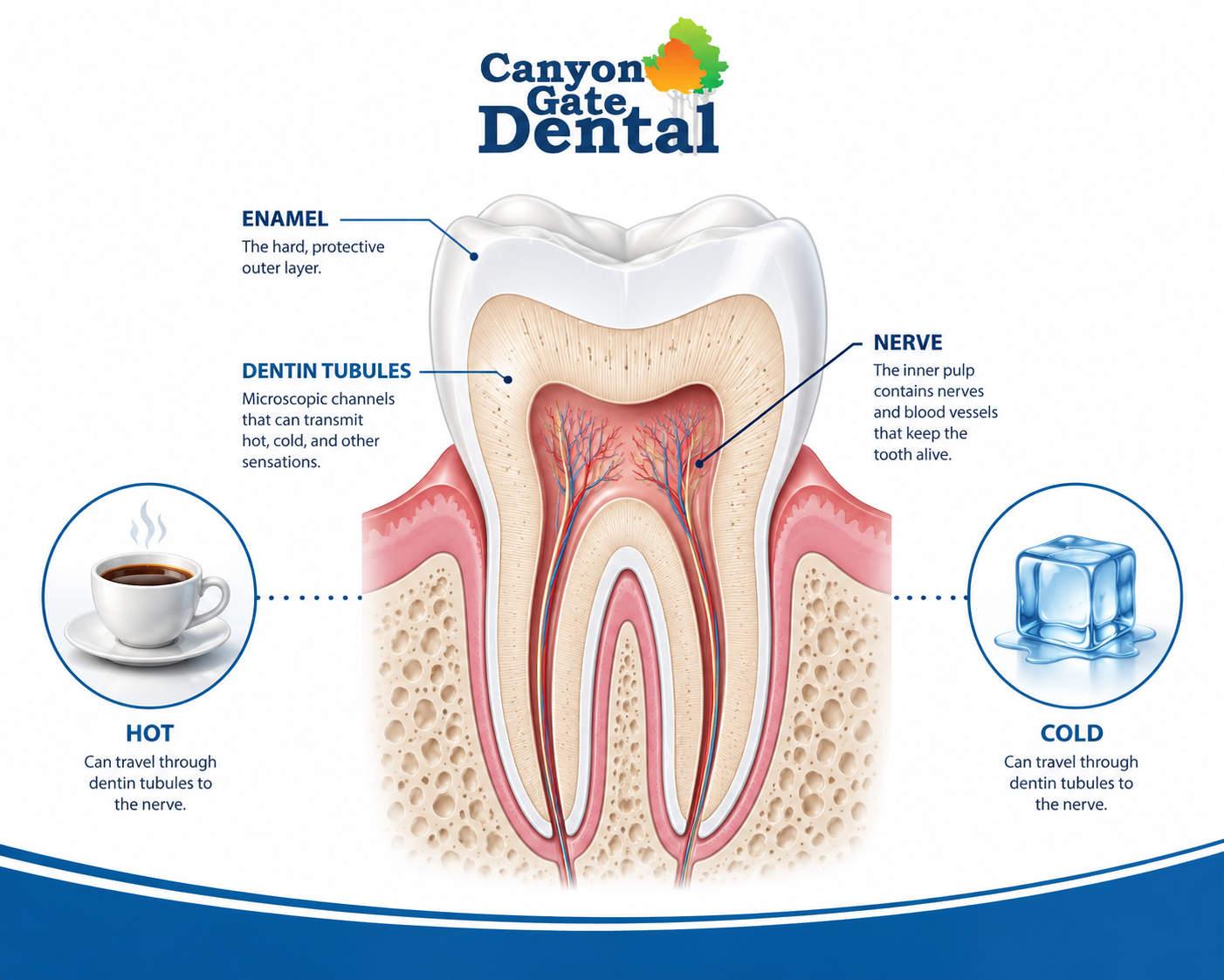 Illustration of tooth cross-section showing enamel and exposed dentin causing sensitivity to hot and cold, Orem UT